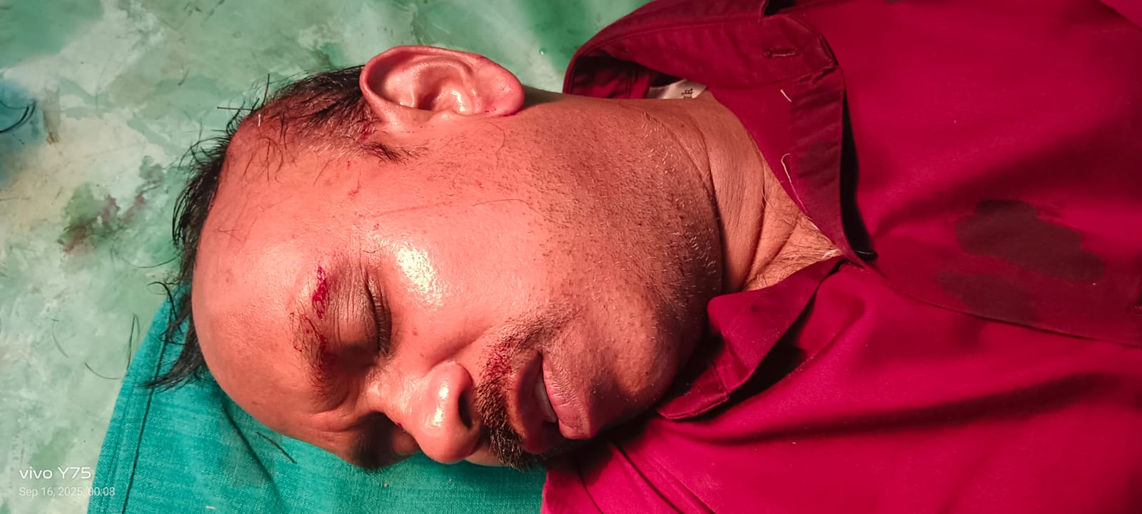 Rajnandgawn news: तेज रफ्तार कार ने पत्रकार शशिकांत देवांगन को मारी   टक्कर, बाल-बाल बचे